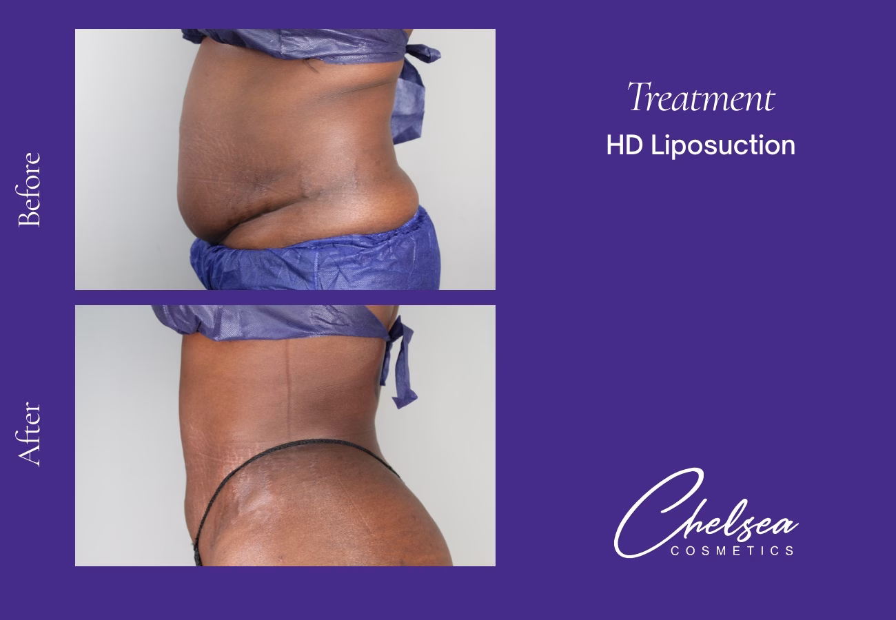 Hd yaskit — Chelsea Cosmetics Melbourne