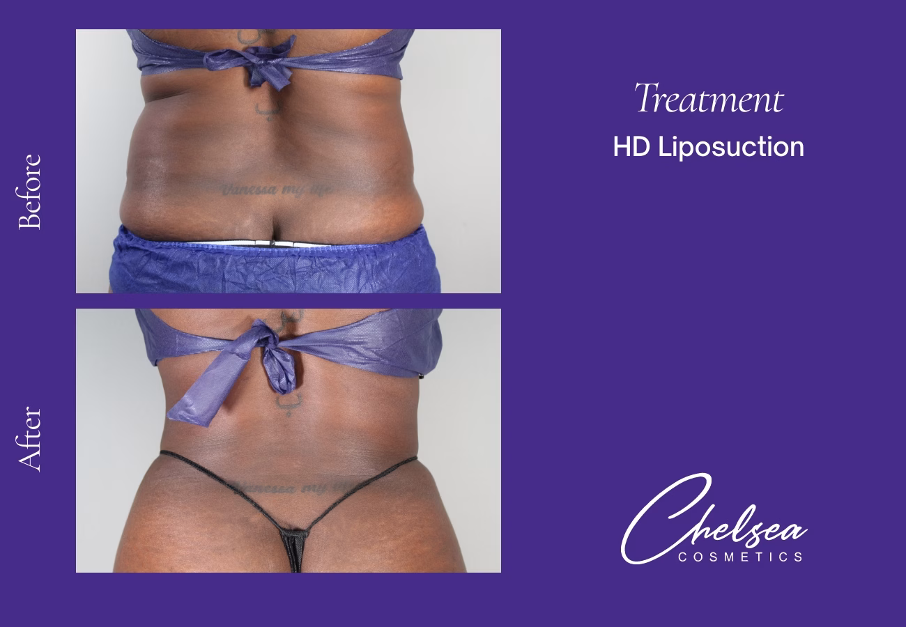 Hd yaskit — Chelsea Cosmetics Melbourne