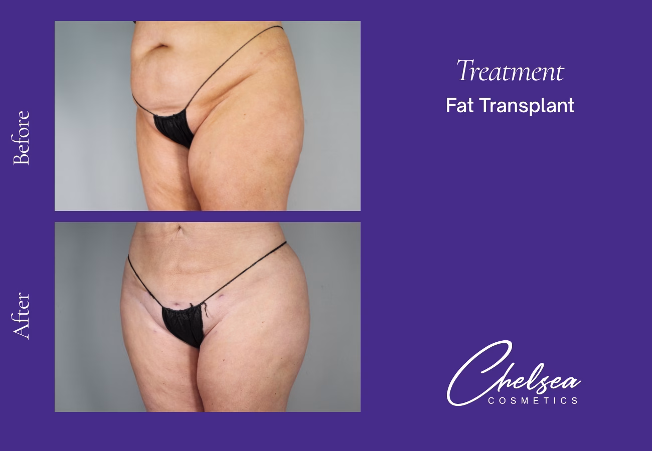 Stem cells — Chelsea Cosmetics Melbourne