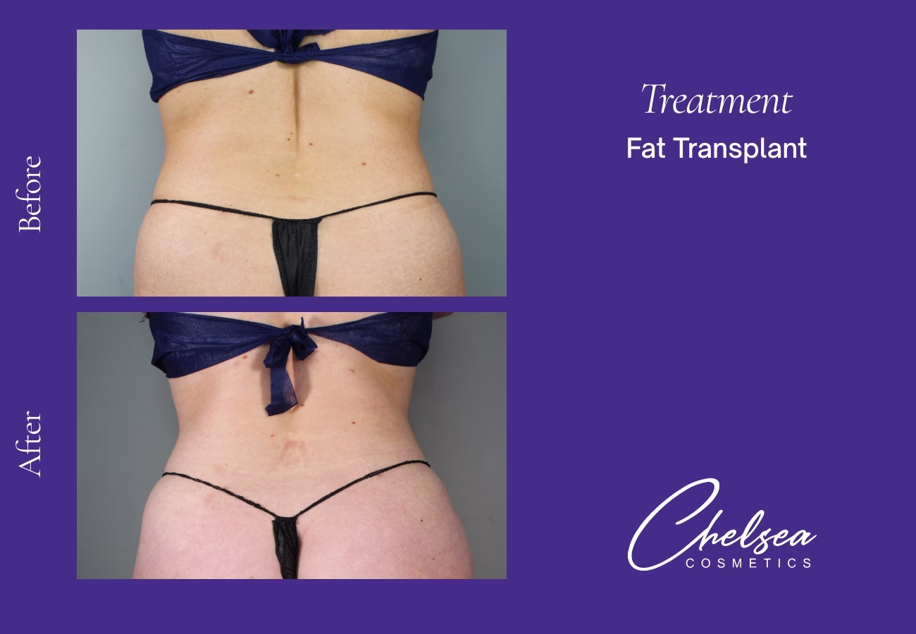 Stem cells — Chelsea Cosmetics Melbourne