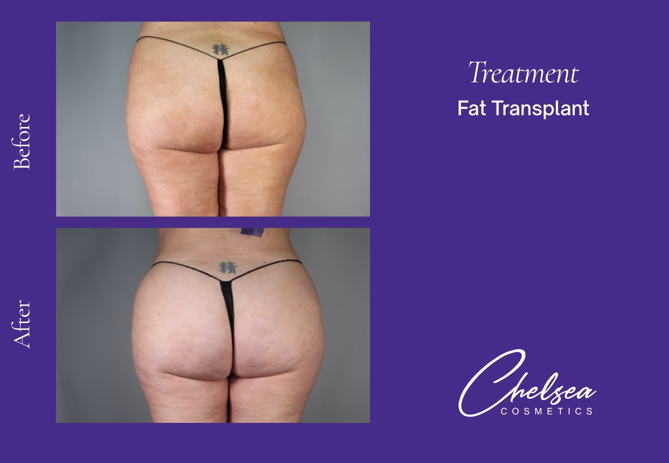 Stem cells — Chelsea Cosmetics Melbourne