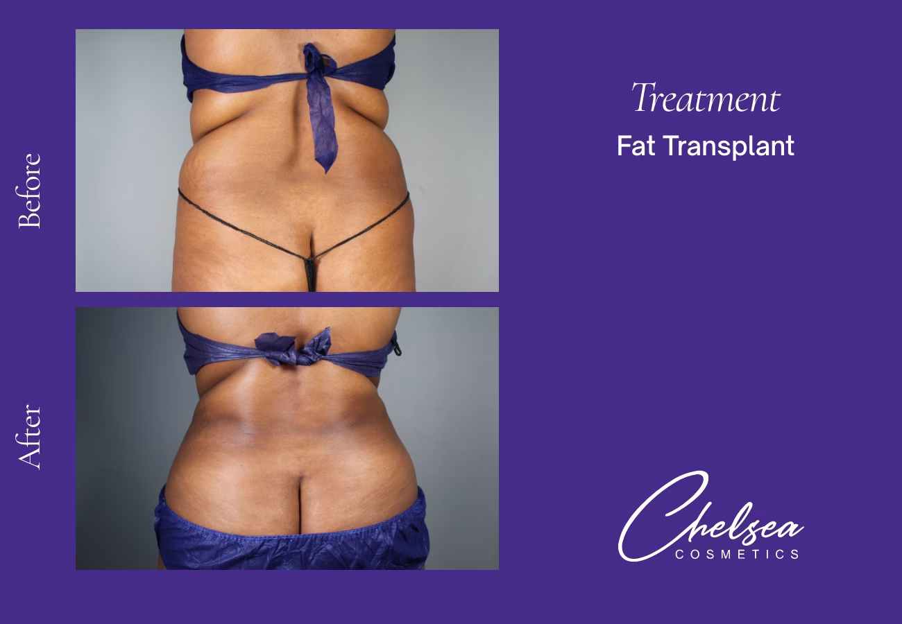 Stem cells — Chelsea Cosmetics Melbourne