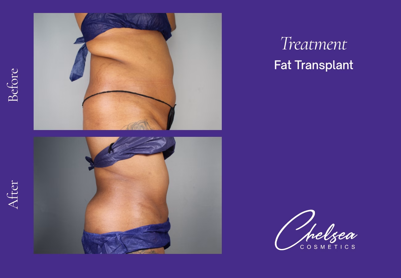 Stem cells — Chelsea Cosmetics Melbourne