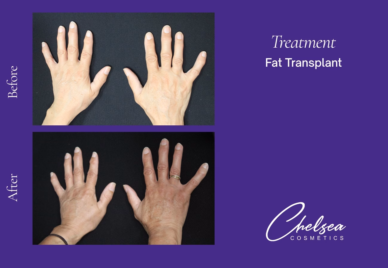 Stem cells — Chelsea Cosmetics Melbourne