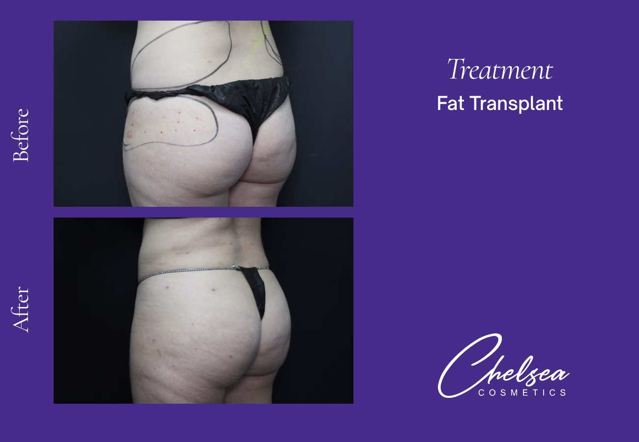 Stem cells — Chelsea Cosmetics Melbourne