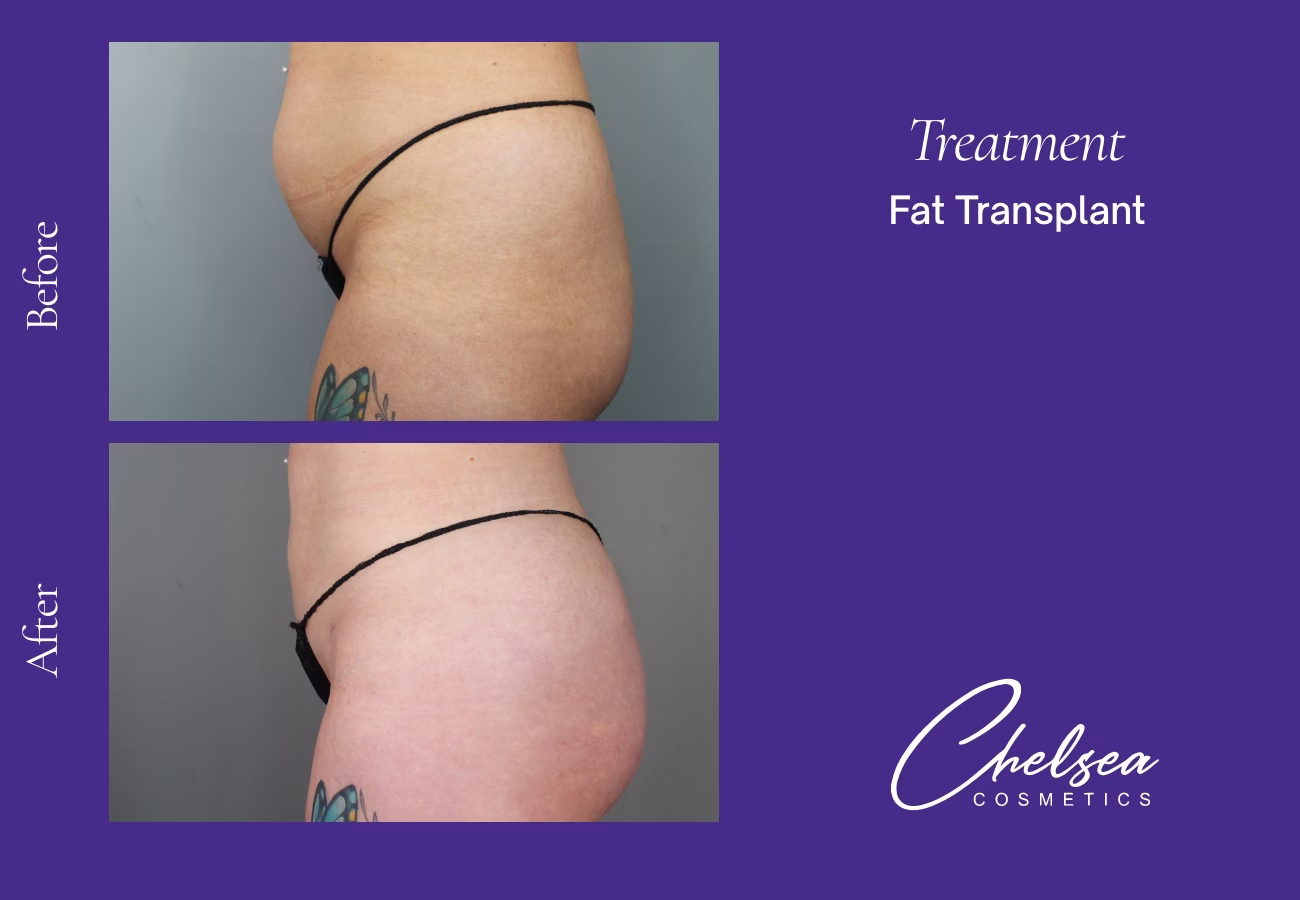 Stem cells — Chelsea Cosmetics Melbourne