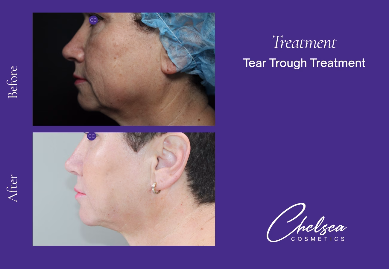 Threads — Chelsea Cosmetics Melbourne