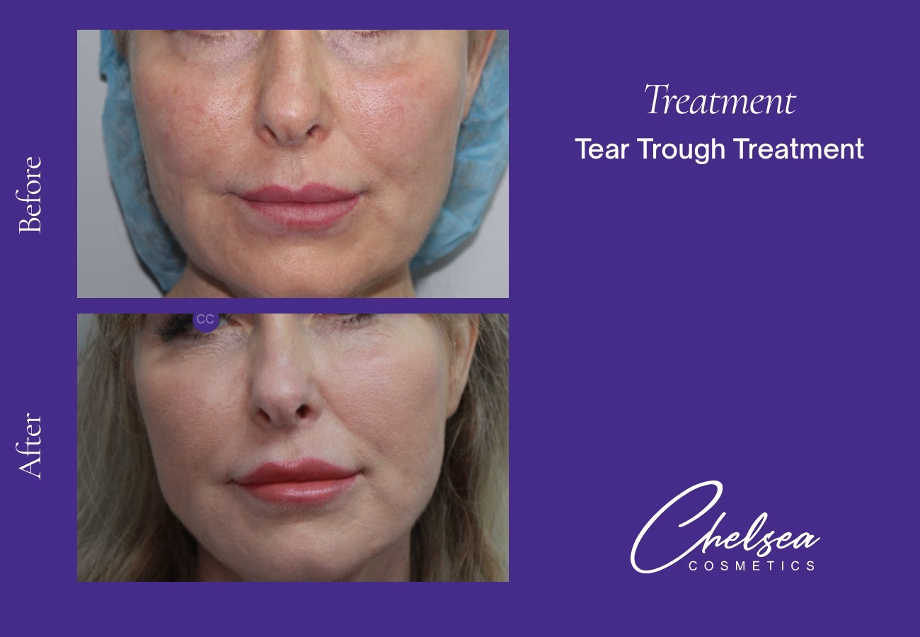 Threads — Chelsea Cosmetics Melbourne